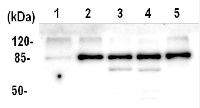 ATPase AAA2 domain in the group Antibodies Plant/Algal  / Environmental Stress / Heat shock at Agrisera AB (Antibodies for research) (AS11 1754)